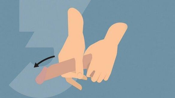 Stretching of the penis for enlargement